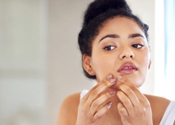 Acne Face Map: What Are Your Breakouts Telling You?