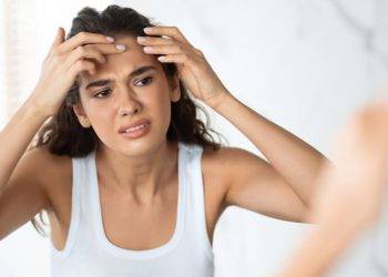 How To Improve The Appearance Of Acne Scars